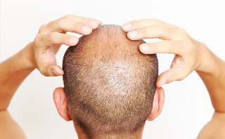 scalp moisturising