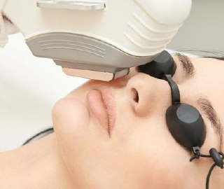 pre laser treatment
